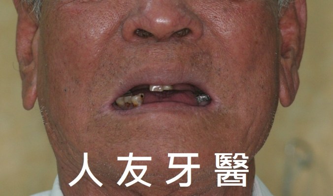 img_6645-e1536737808269