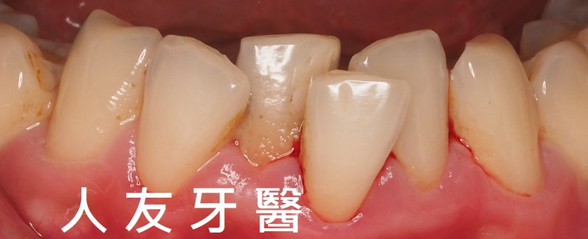 p9120187-e1536737221130